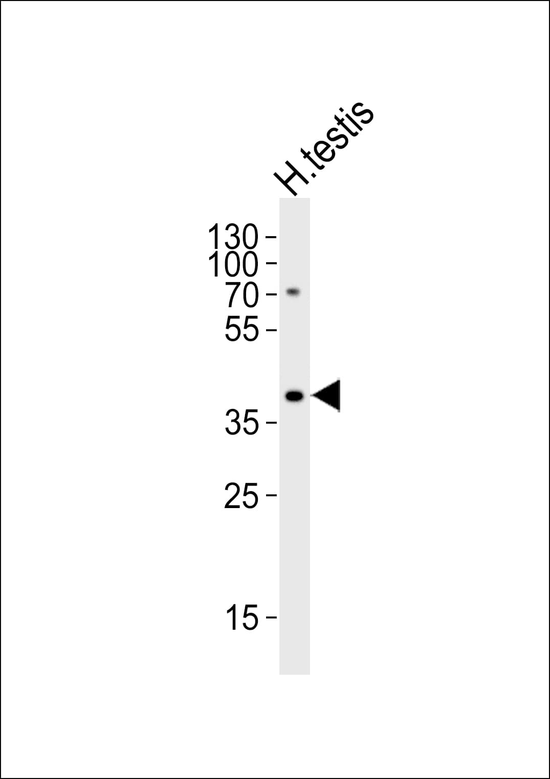 Polyclonal Rabbit anti-Human TSPY2 Antibody (aa86-120, WB)