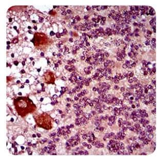 Monoclonal Mouse anti-Human DNM1L / DRP1 Antibody (clone 4E11B11, aa100-250, IHC, WB)