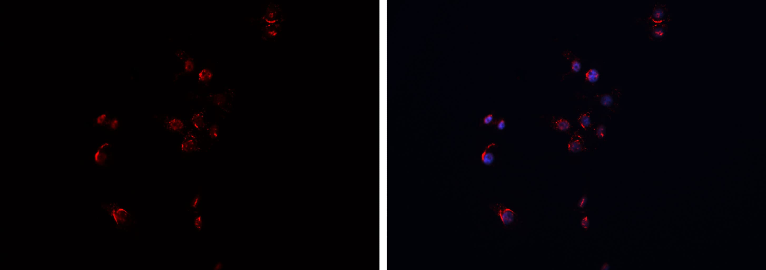 APP / Beta Amyloid Precursor Antibody