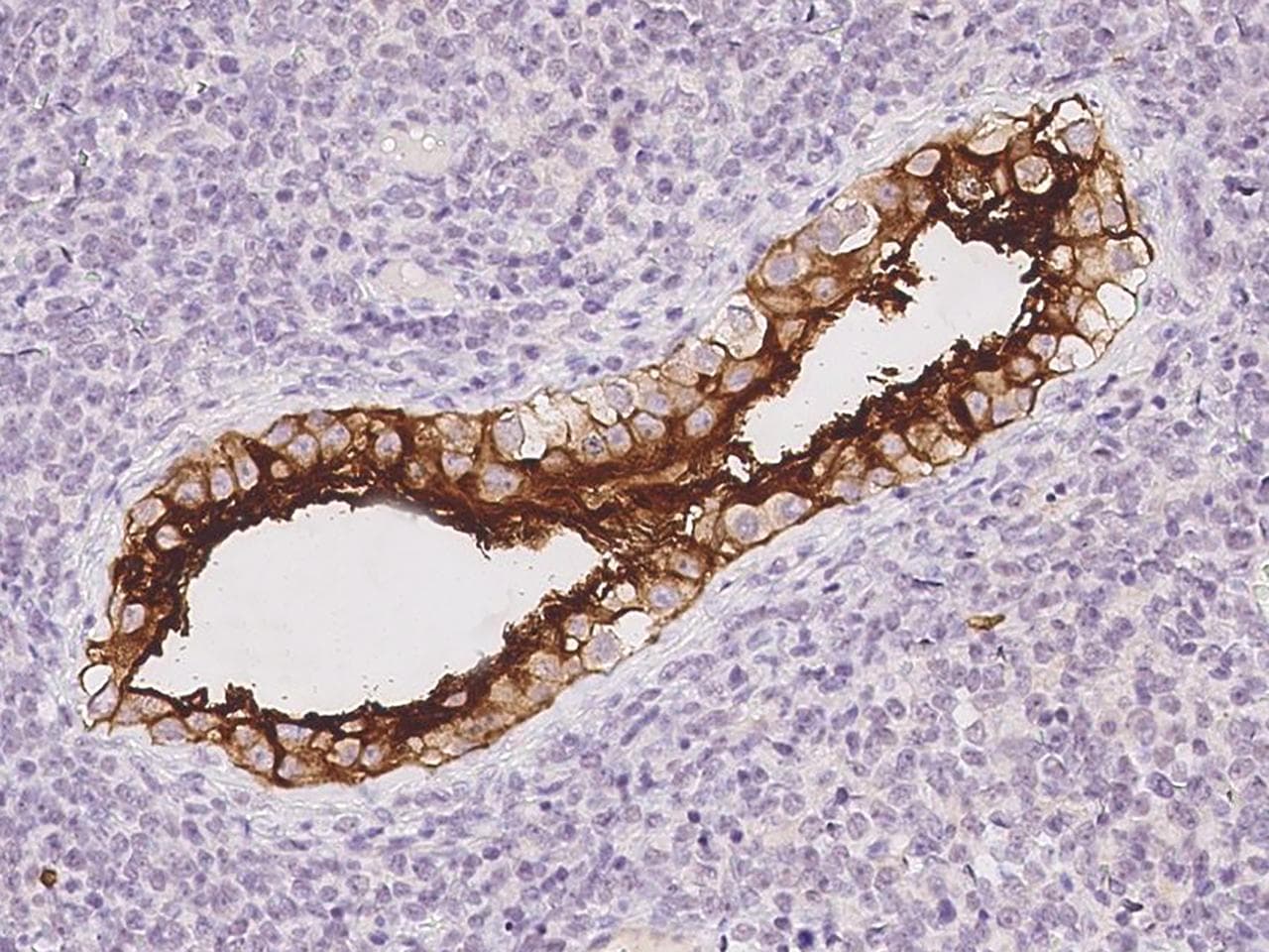 Polyclonal Rabbit anti-Human PRND / DOPPEL Antibody (Preservative Free, IHC)