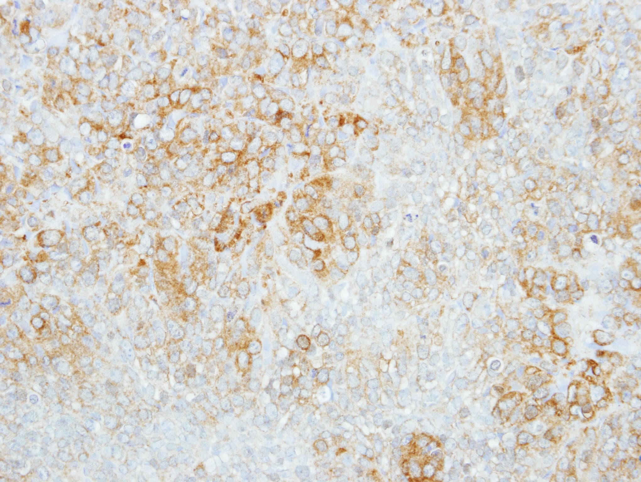 GBA / Glucosidase Beta Acid Antibody (aa352-536)