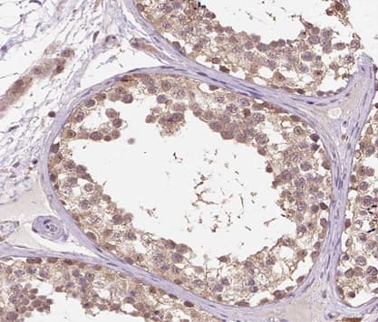 DDIT3 / CHOP Antibody