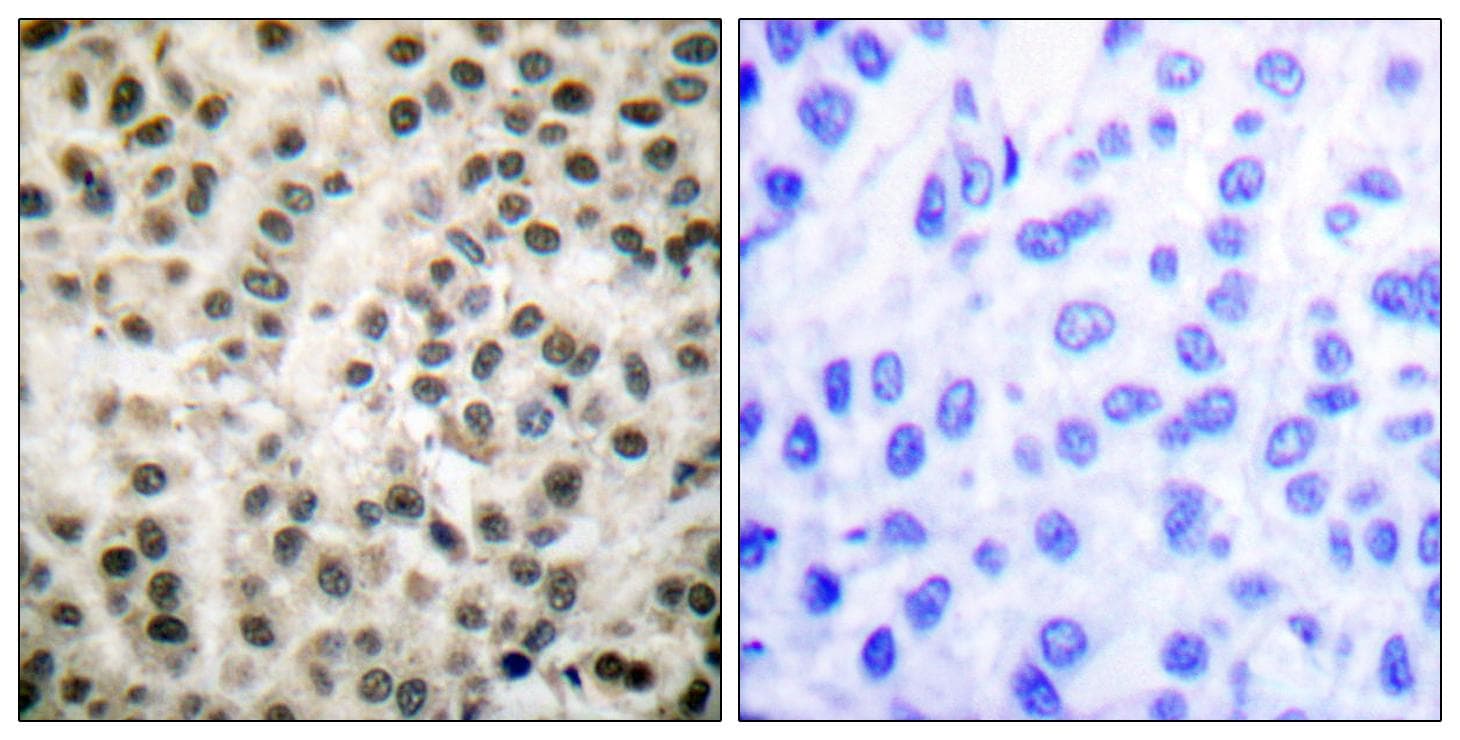 Polyclonal Rabbit anti-Human MEF2A / MEF2 Antibody (p408, IHC, IF, WB)