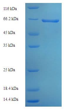 Rabies Virus gG Protein (Recombinant His-SUMO)