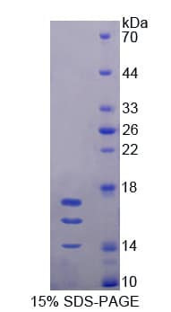 Mouse IL15 Protein (Recombinant His)