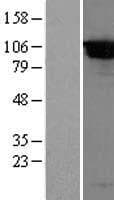 Dipeptidylpeptidase 8 / DPP8 Protein (Over-Expression Lysate Myc-DDK (Flag))