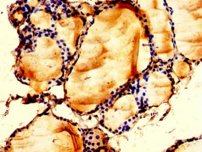 Polyclonal Rabbit anti-Human LPCAT2 Antibody (IHC, WB)