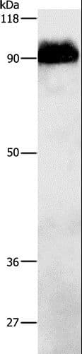 Beta Amyloid Antibody