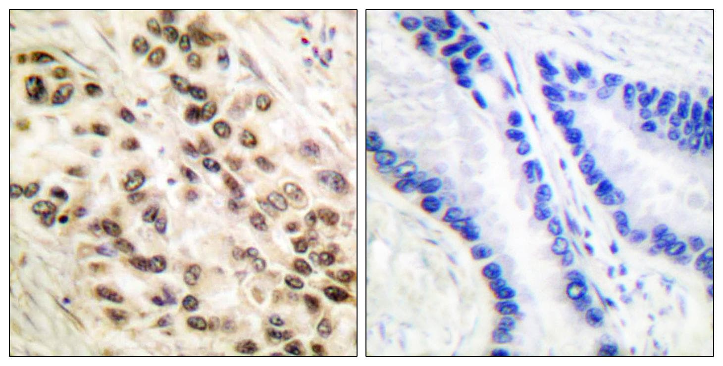 C/EBP Beta / CEBPB Antibody (p235/188)