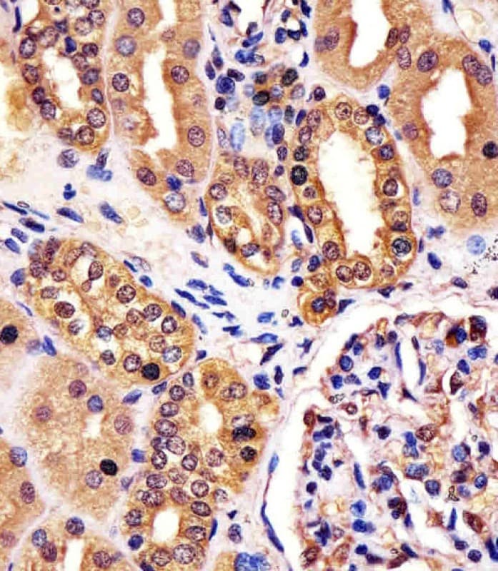 Polyclonal Rabbit anti-Human RNF7 Antibody (aa25-57, IHC, WB)