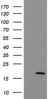 IHC-plus™ UBE2G2 Antibody (clone 4D6)