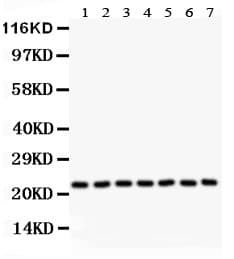 GSTP1 / GST Pi Antibody (aa2-210)
