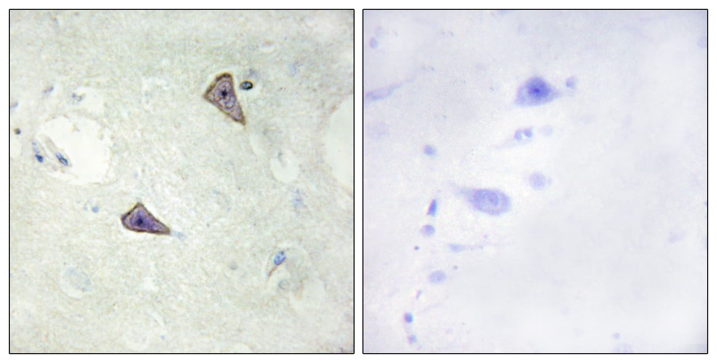 Polyclonal Rabbit anti-Human RET Antibody (phospho-Tyr905, IHC, IF)