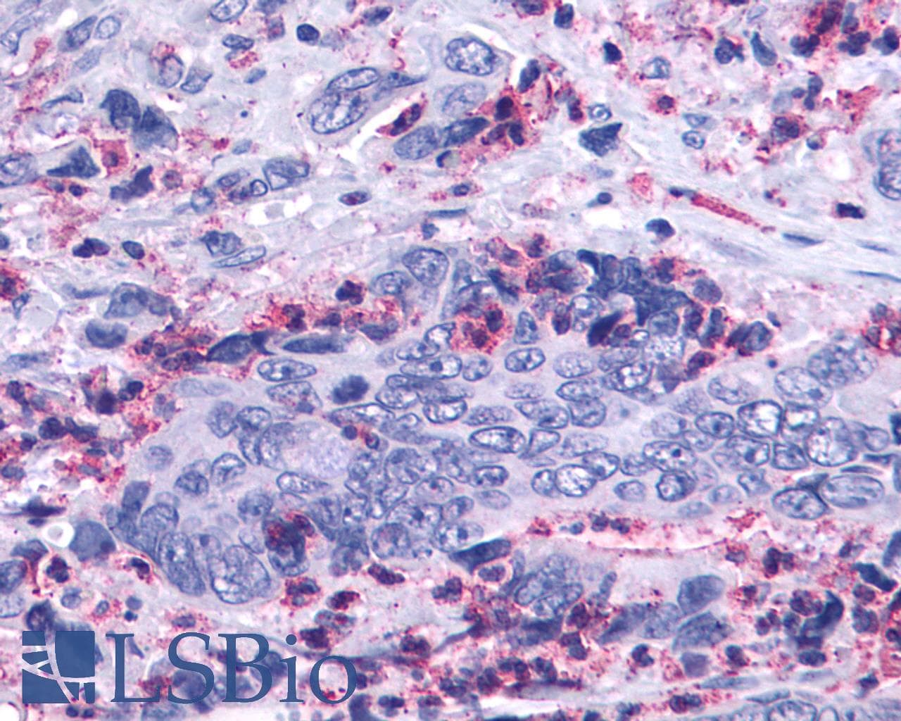 PathPlus™ LTB4R2 / BLT2 Antibody (Cytoplasmic Domain)