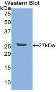 PVRL3 / Nectin-3 Antibody (aa171-377)