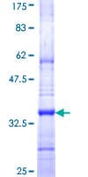 Human ICMT / PPMT Protein (Recombinant GST, N-terminus)