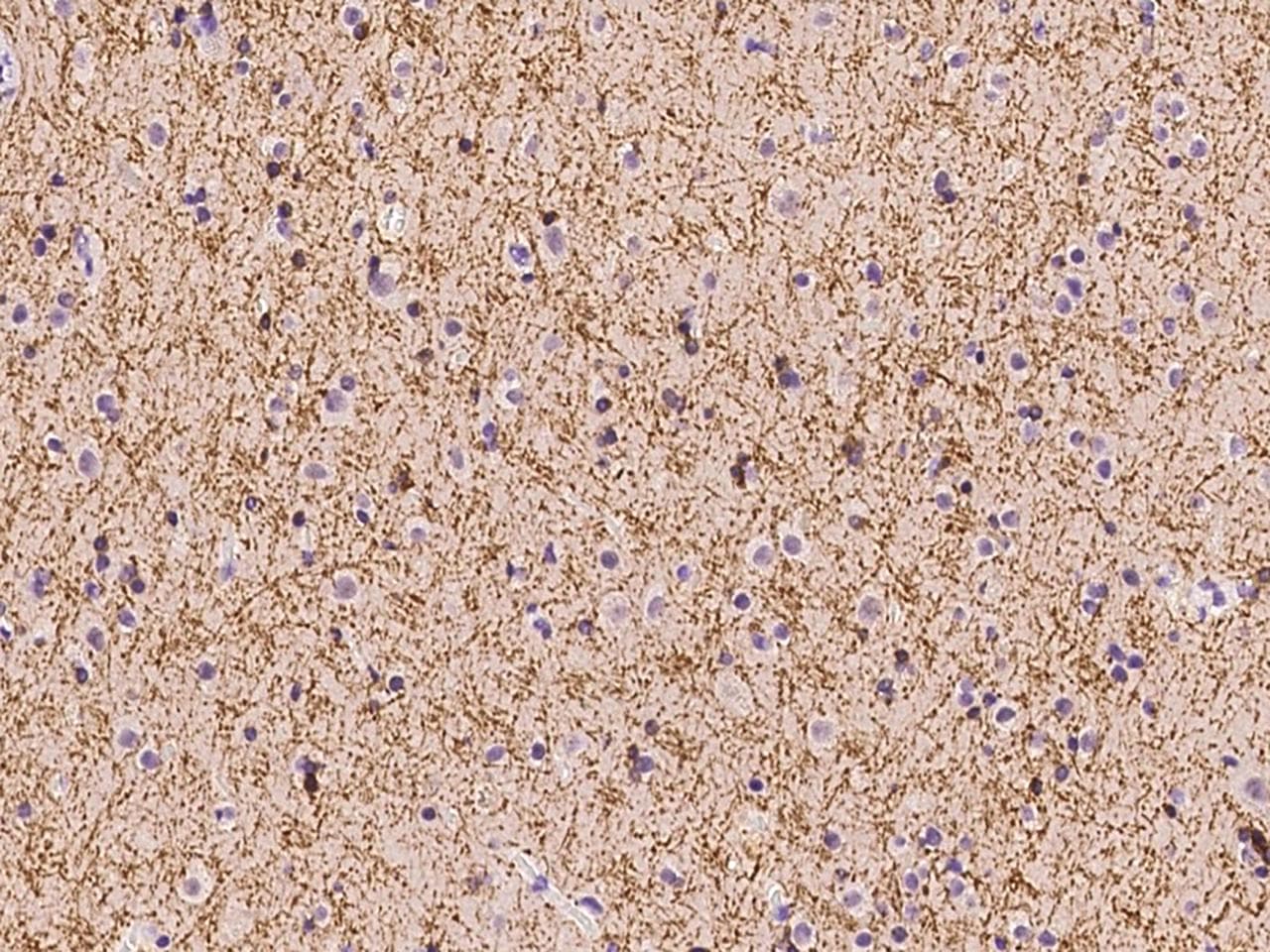 SIRT2 / Sirtuin 2 Antibody