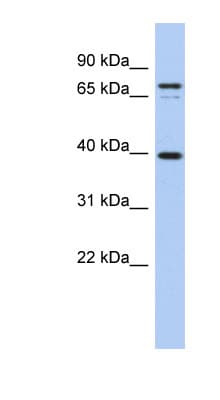Polyclonal Rabbit anti-Human MS4A14 / MS4A13 Antibody (aa575-624, WB)