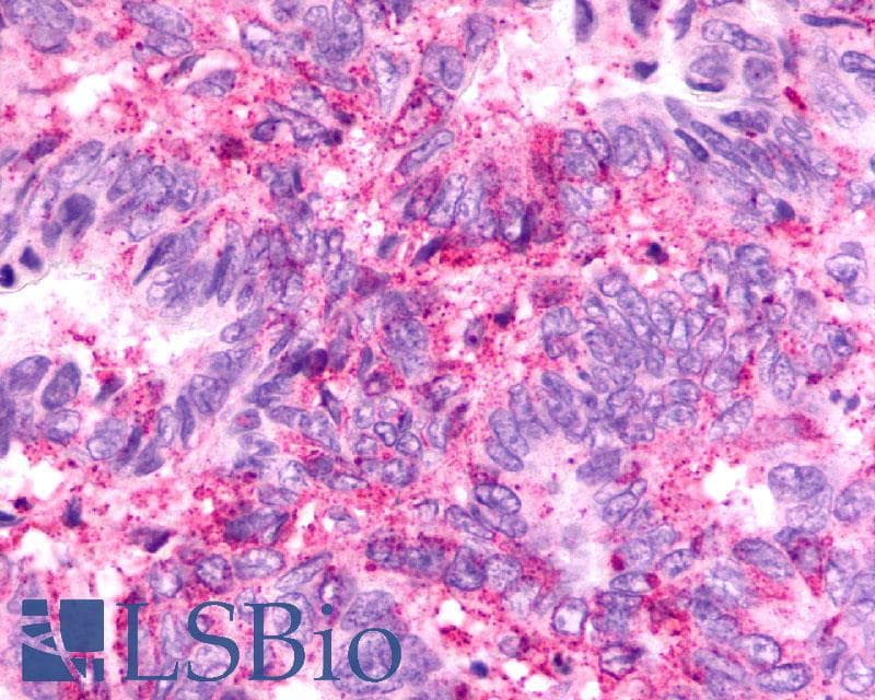 PathPlus™ Polyclonal Rabbit anti-Human CXCR2 Antibody (Extracellular Domain, IHC)