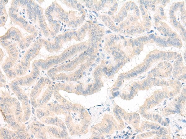Polyclonal Rabbit anti-Human AOAH / Acyloxyacyl Hydrolase Antibody (IHC)