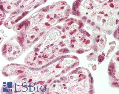 IHC-plus™ Polyclonal Rabbit anti-Human SMG9 Antibody (aa75-125, IHC)