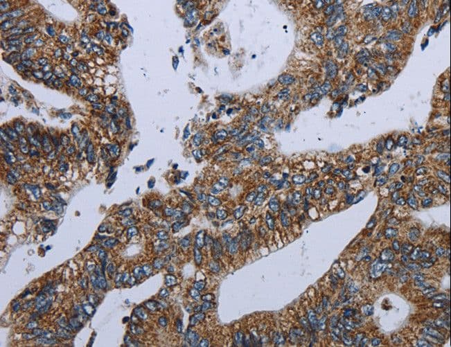 NDUFA13 / GRIM19 Antibody
