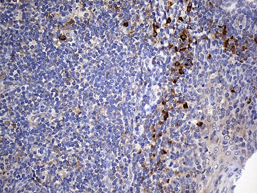NAT1 / AAC1 Antibody (clone OTI6D7, Carrier-free)
