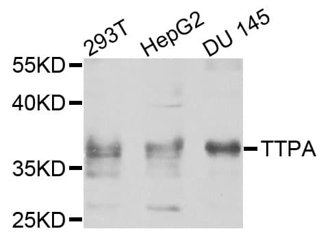 TTPA Antibody
