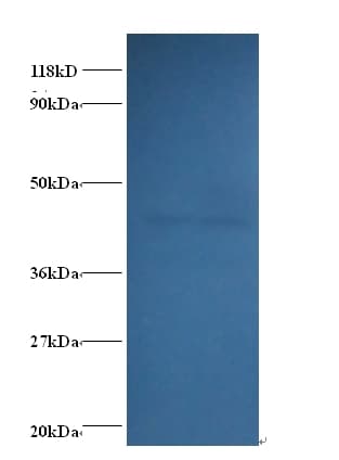 ALDOA / Aldolase A Antibody