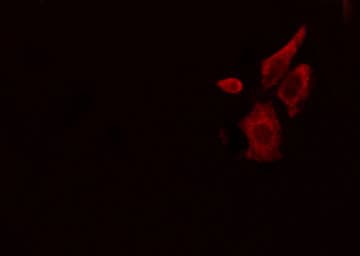 Polyclonal Rabbit anti-Human HLA-DPA1 Antibody (IF, WB)