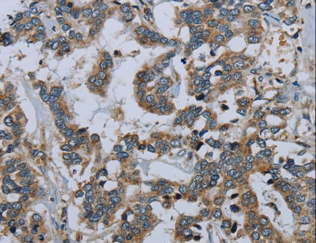 PCK2 / PEPCK Antibody