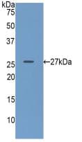 GUSB / Beta Glucuronidase Antibody (aa451-649)