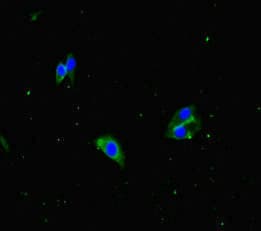 APH1A / APH-1 Antibody
