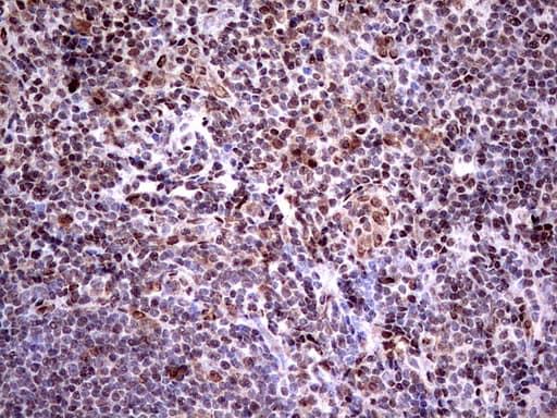 C14orf166 Antibody (clone UMAB175)