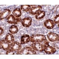 Polyclonal Rabbit anti-Human DDIT4 / REDD1 Antibody (IHC, IF, WB)