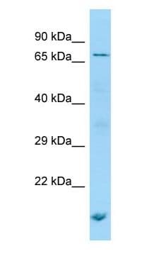 Polyclonal Rabbit anti-Human POF1B Antibody (aa29-78, WB)