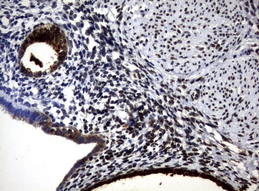 WFDC2 / HE4 Antibody (aa31-124, clone UMAB88)