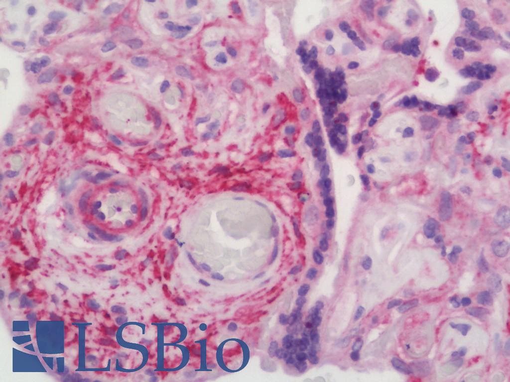 IHC-plus™ MNK / ATP7A Antibody (aa591-640)