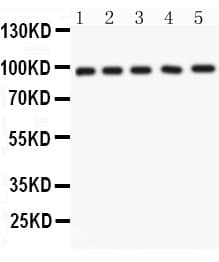 NUP98 Antibody (aa549-880)