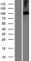 KIAA0703 / SPCA2 Protein (Over-Expression Lysate Myc-DDK (Flag))