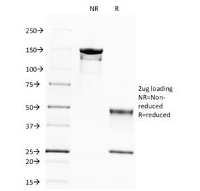 Monoclonal Mouse anti-Human SPTBN2 Antibody (clone SPTBN2/1583, IHC, IF, WB)