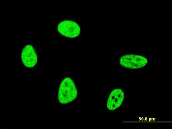 Monoclonal Mouse anti-Human OXSR1 / OSR1 Antibody (clone 6C7, IHC, IF, WB)
