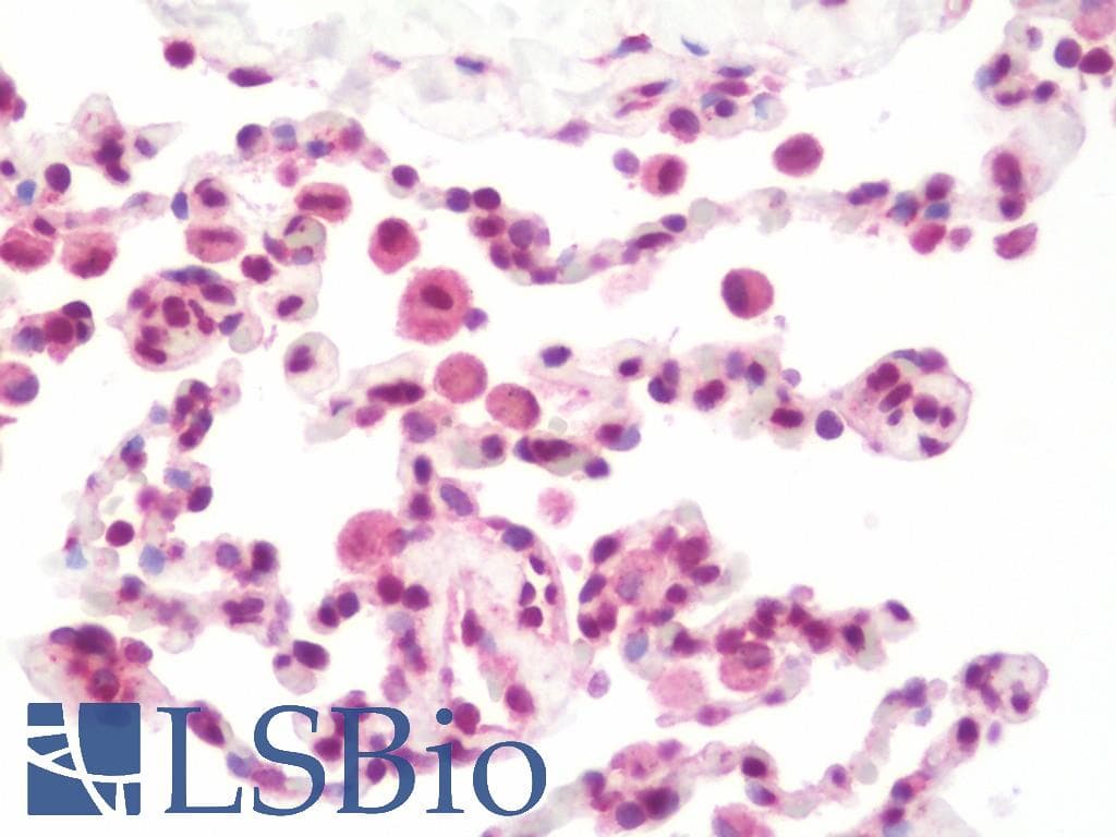 IHC-plus™ PTF1A Antibody (aa12-43)