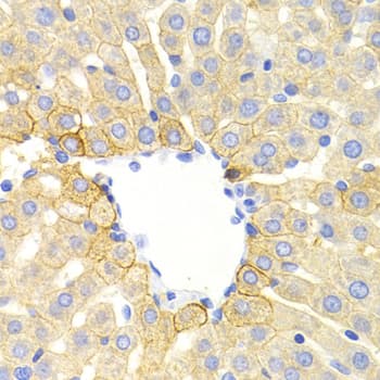 DRD1 / Dopamine Receptor D1 Antibody (aa338-446)