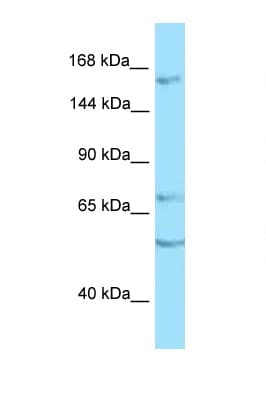 PTPRT Antibody (aa1340-1389)