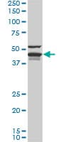 IHC-plus™ Monoclonal Mouse anti-Human DNAJA4 Antibody (clone 4B4-1F2, IHC, IF, WB)