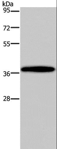 Polyclonal Rabbit anti-Human BP1 / DLX4 Antibody (WB)