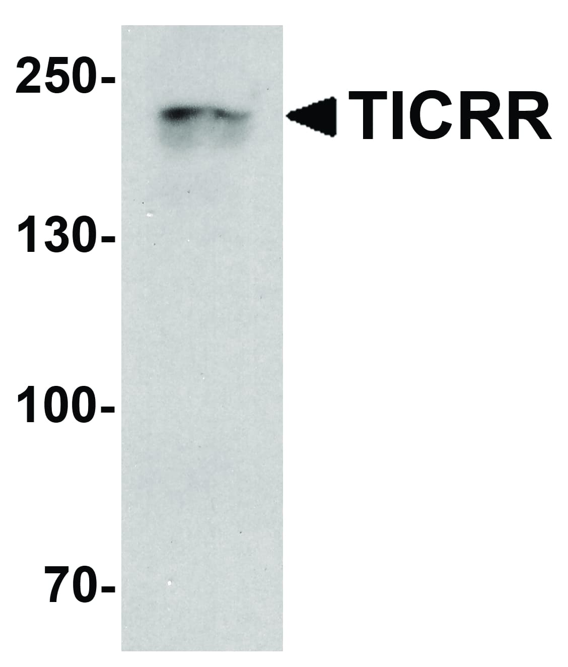IHC-plus™ TICRR Antibody