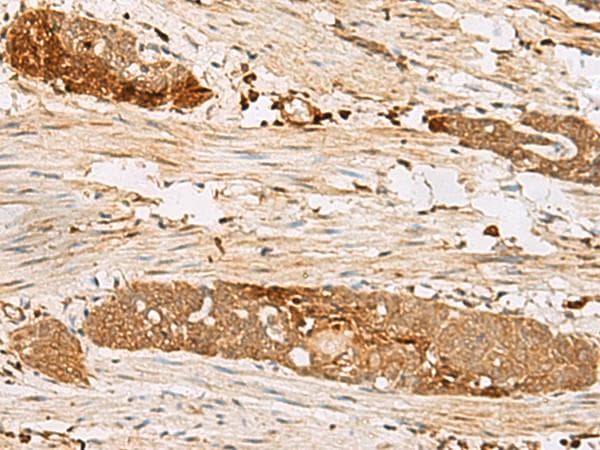 PSMD12 / Rpn5 Antibody