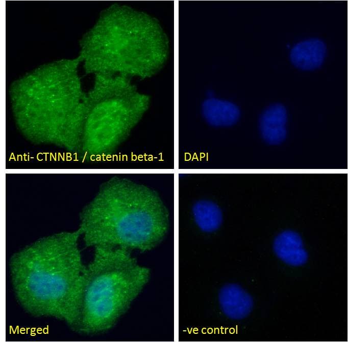 IHC-plus™ CTNNB1 / Beta Catenin Antibody